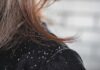 Unpacking the Link Between Dandruff and Hair Loss: What You Need to Know